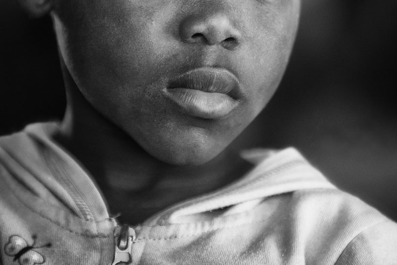 Somalia: bambina di 10 anni muore dopo l’asportazione del clitoride