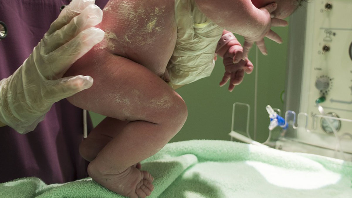 Bambina tetraplegica dopo il parto: l’ospedale non vuole risarcire