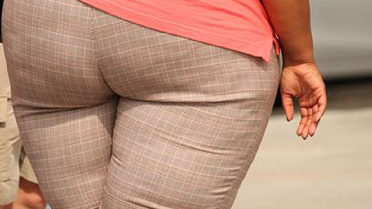 obesa