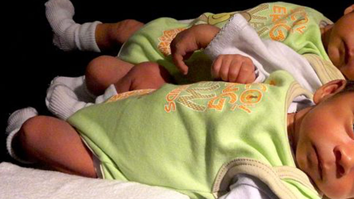Bari, gemelli nati in due anni diversi: la storia di Andrea e Fabio è una bufala
