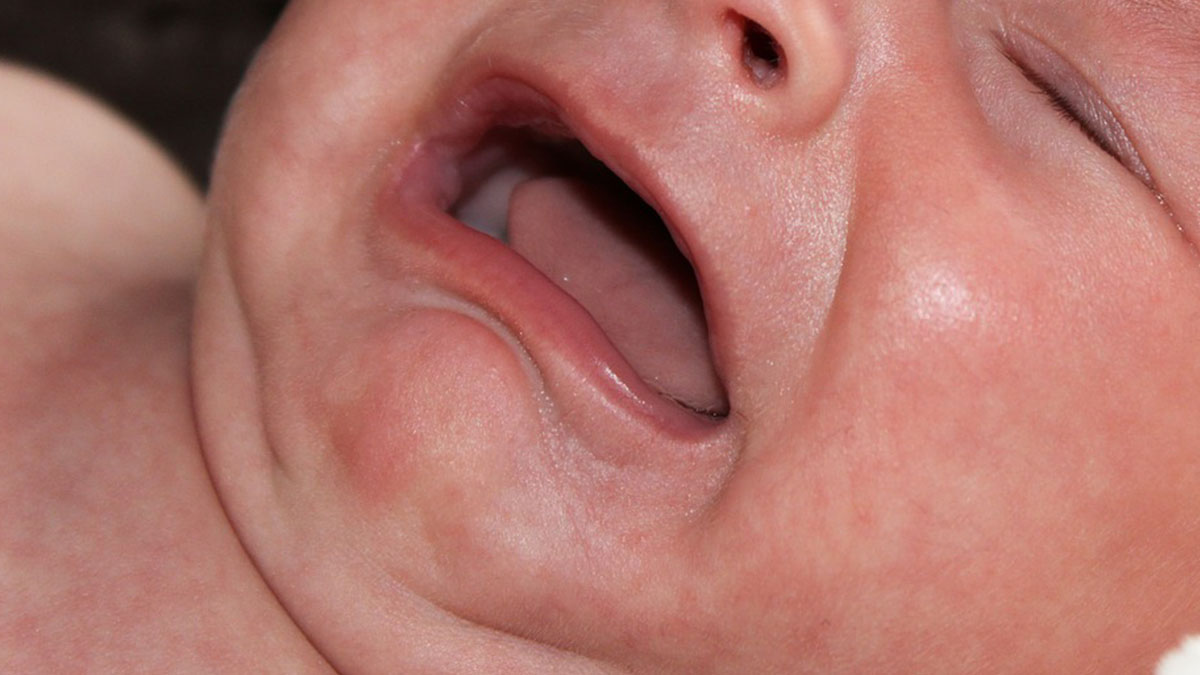neonato