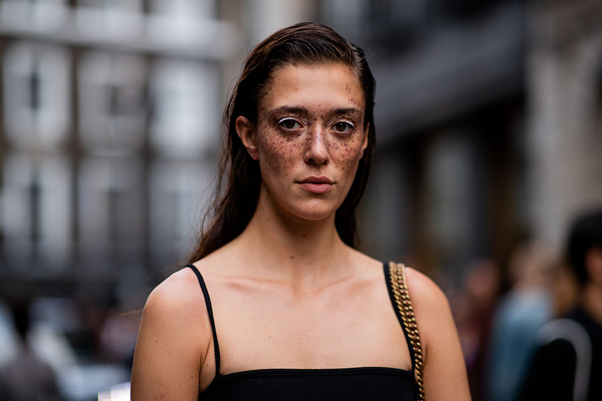 ragazza lentiggini