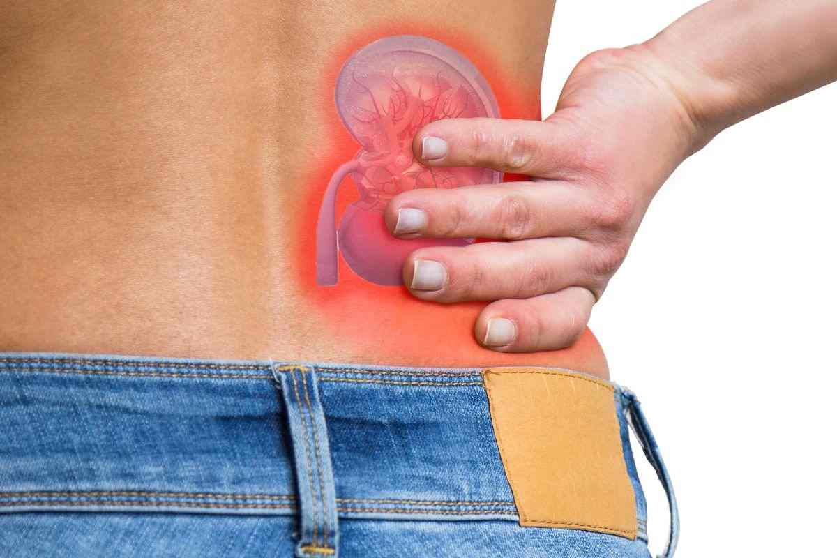 Come espellere i calcoli renali in maniera naturale: lo dicono gli americani