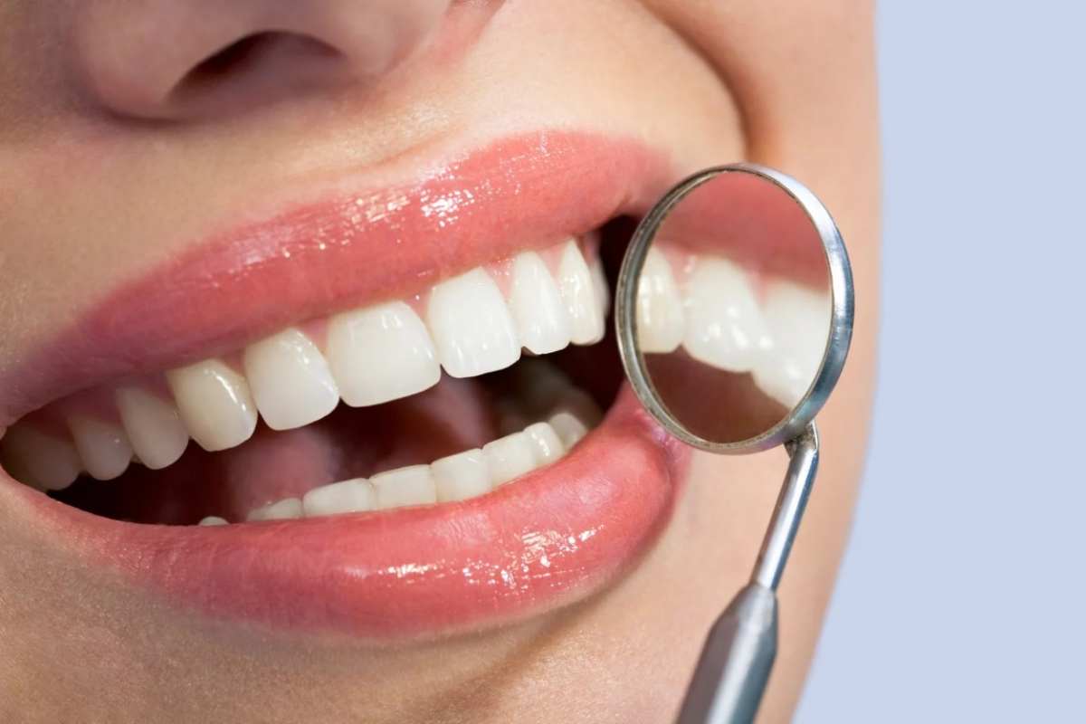Denti sani e forti: gli alimenti da eliminare che a lungo andare li danneggiano irreversibilmente