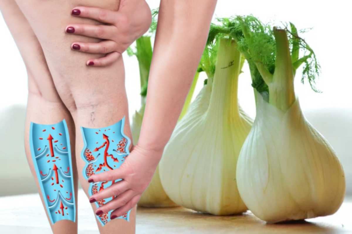 Gambe gonfie? Il rimedio arriva dalla natura: le incredibili proprietà del finocchio