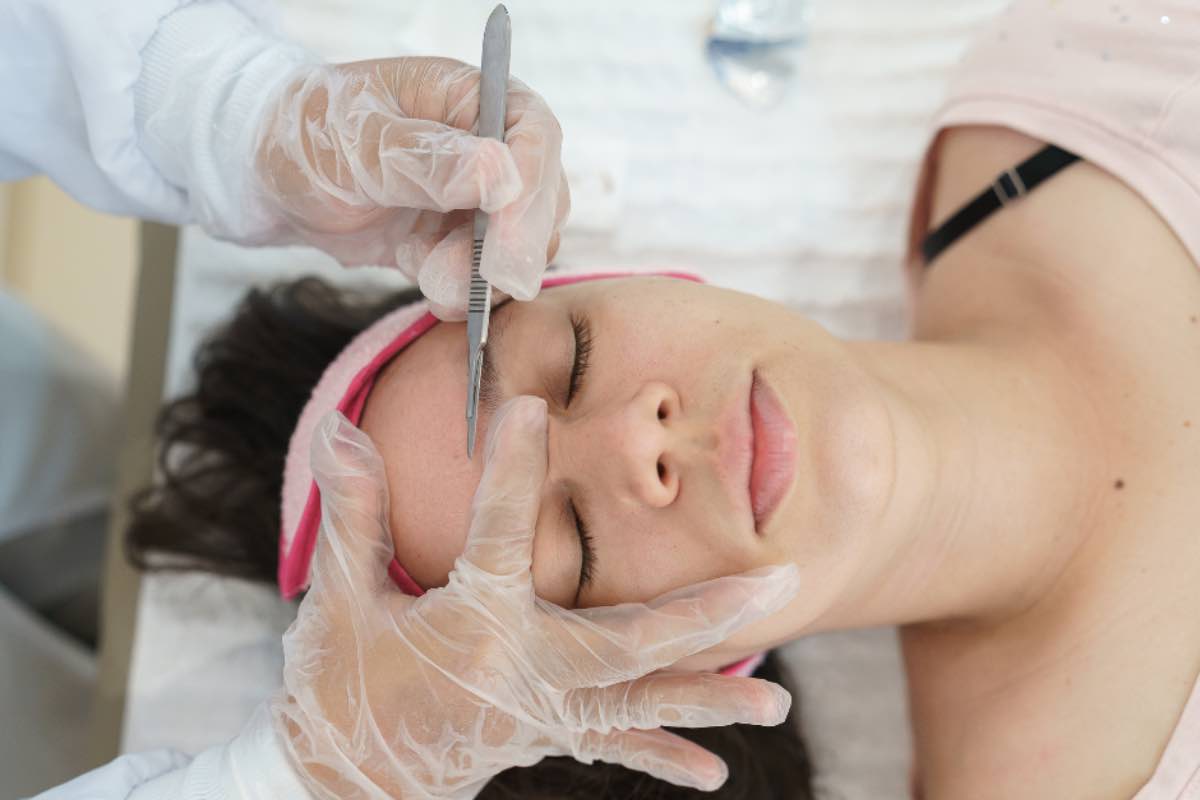 Dermaplaning, cos’è il trattamento per la bellezza della pelle del viso amato dalle star