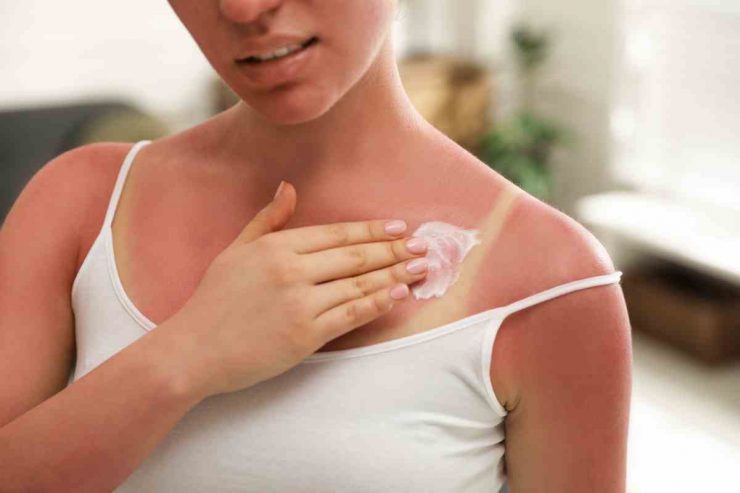 I segnali che qualcosa non va quando sei al sole: attenzione a questo