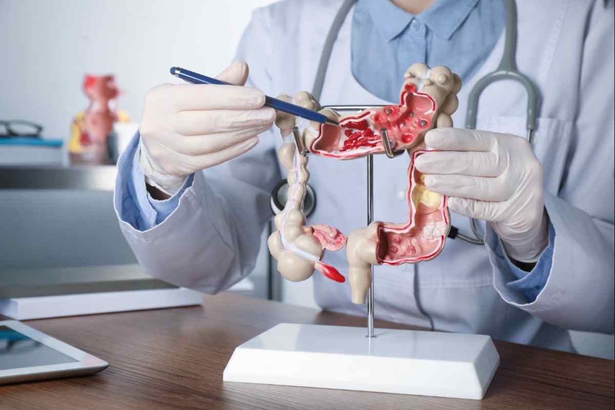 Crampi, gonfiori, meteorismo: cos’è il colon irritabile, le possibili cause e come comportarsi