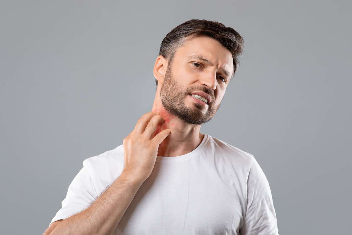 Dermatite: cause, sintomi e trattamenti di questa fastidiosa infiammazione della pelle