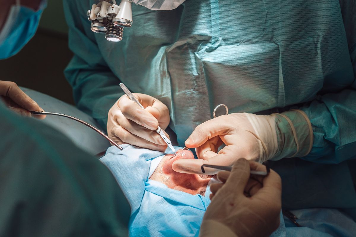 La chirurgia è una della opzioni possibili nella risoluzione del rinofima
