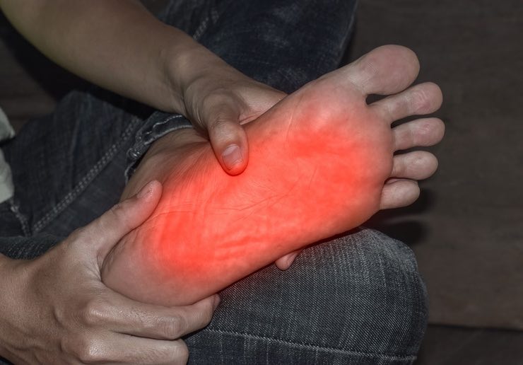 Piedi: cosa fare in caso di ustione