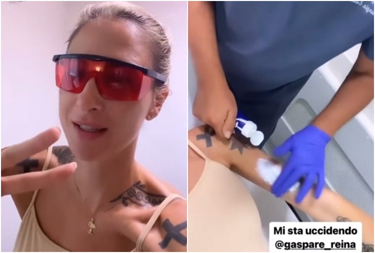 Ema Stokholma rimuove i tatuaggi