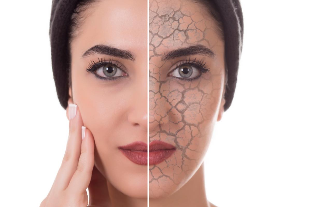 Invecchiamento precoce della pelle, perché è così importante rigenerare la cute del viso dopo le vacanze: i trattamenti giusti