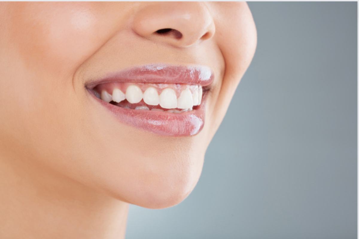 Sorriso luminoso e sbiancamento dei denti: come funziona, a chi è consigliato e cosa occorre sapere