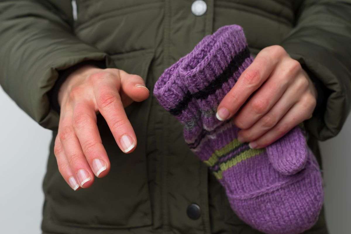 Dita bianche a causa del freddo, cos’è il Fenomeno di Raynaud e come intervenire