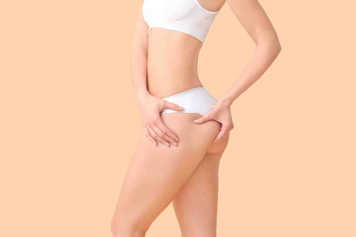 Rimedi naturali contro la cellulite