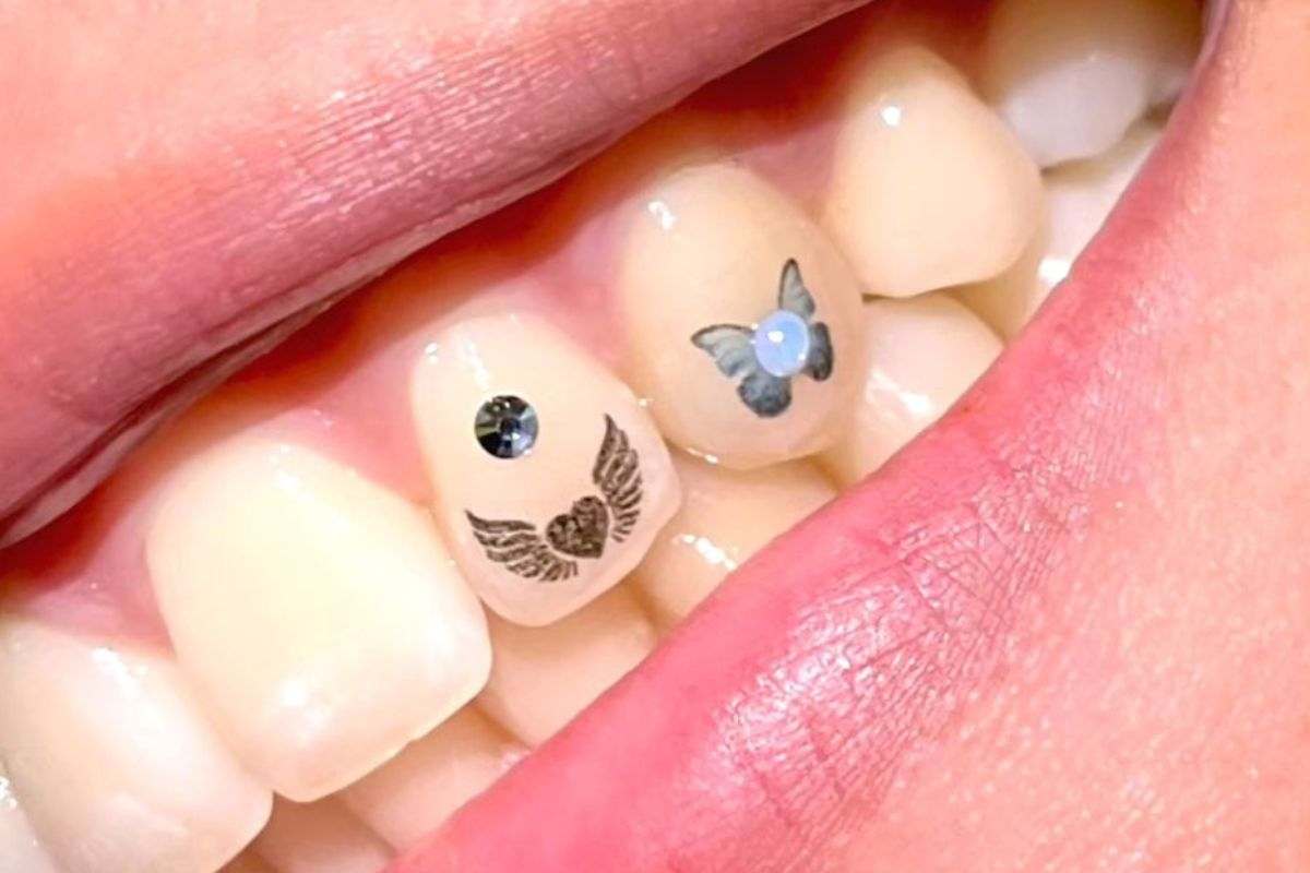 La moda del momento, i tatuaggi sui denti conosciuti con il termine di Tattooth