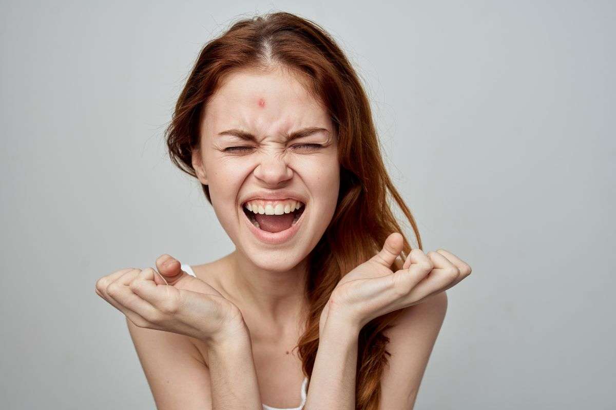 ragazza con brufoletto sulla fronte