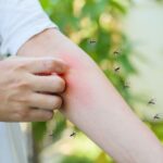 persona che si gratta il braccio