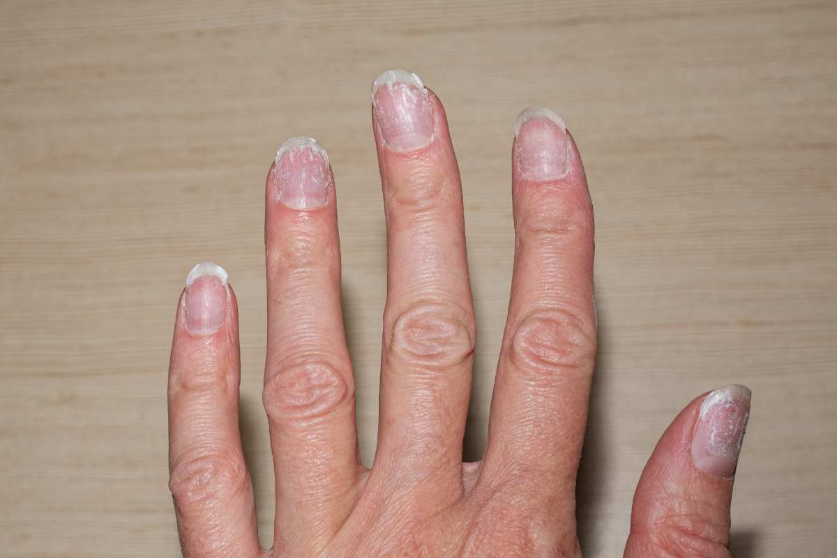 Unghie fragili e rovinate - pourfemme.it