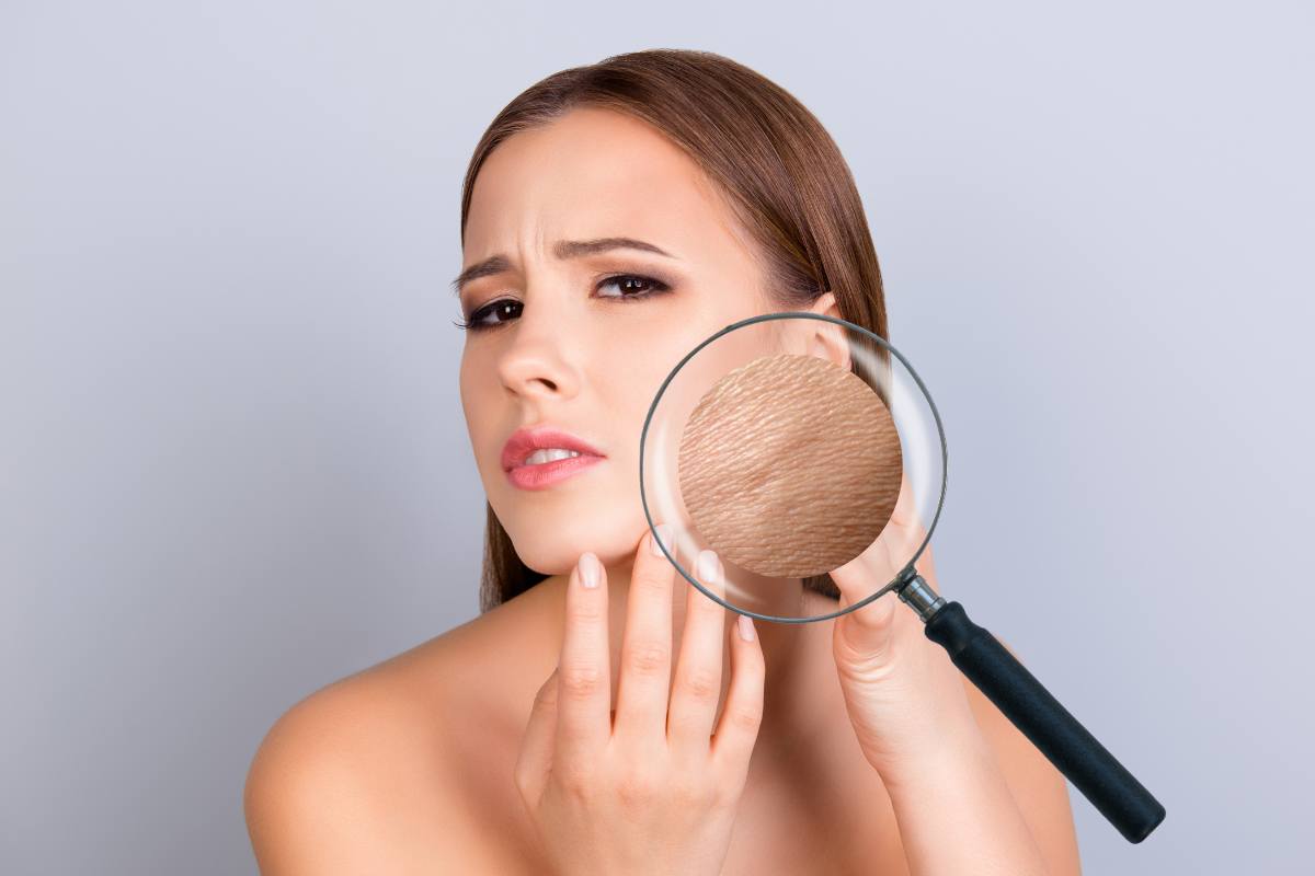 Donna cha la pelle del viso secca