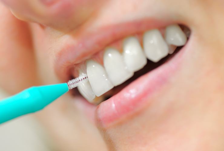 Pulire denti con lo scovolino 