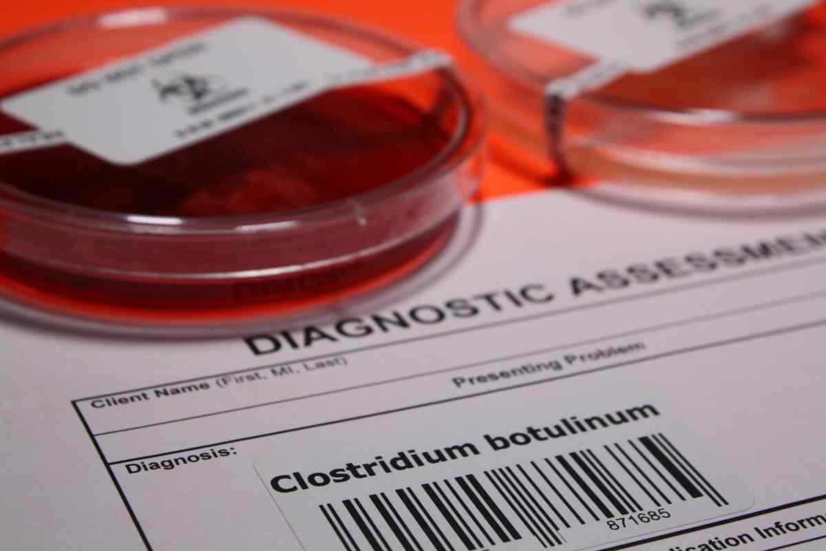diagnosi dei sintomi di intossicazione da botulino e analisi in vitro