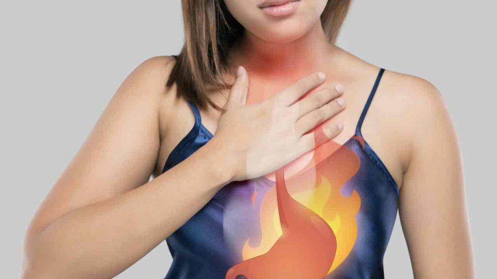 reflusso gastroesofageo