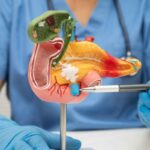 Cancro al pancreas, scoperta la proteina che rende inefficaci i farmaci: nuova speranza dalla ricerca