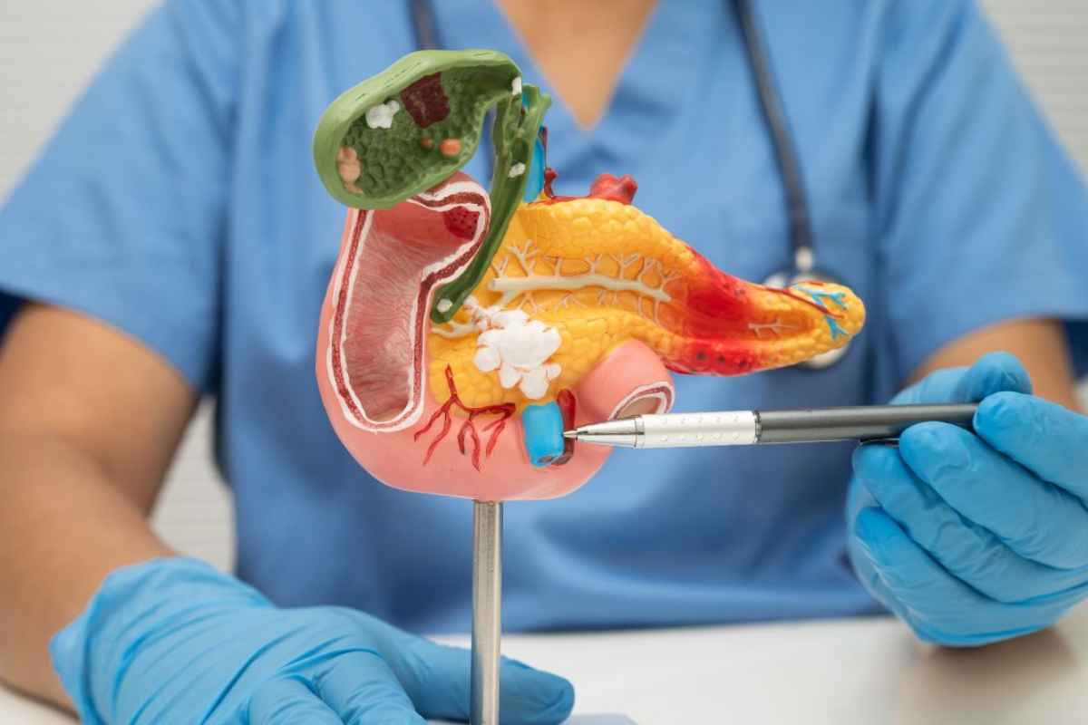 Cancro al pancreas, scoperta la proteina che rende inefficaci i farmaci: nuova speranza dalla ricerca