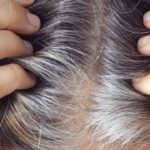 Capelli bianchi a 20 anni cosa fare - Pourfemme.it