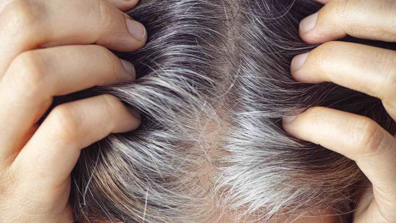 Capelli bianchi a 20 anni cosa fare - Pourfemme.it