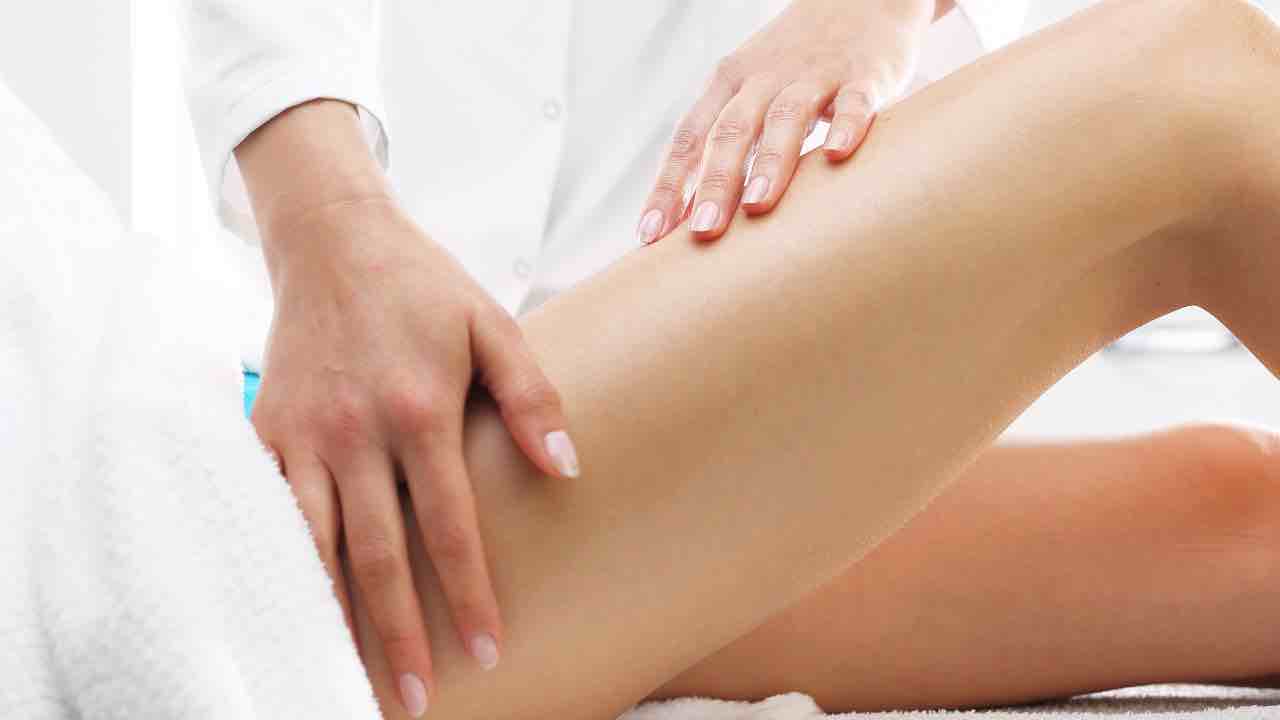 cellulite
