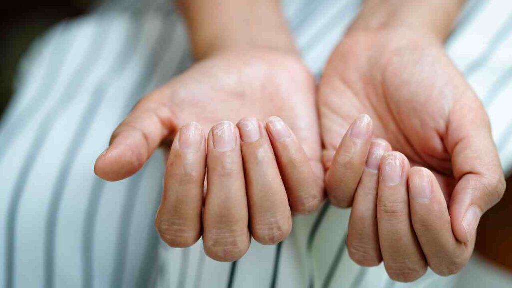Come curare le unghie che si spezzano facilmente - Pourfemme.it