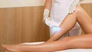 epilazione laser