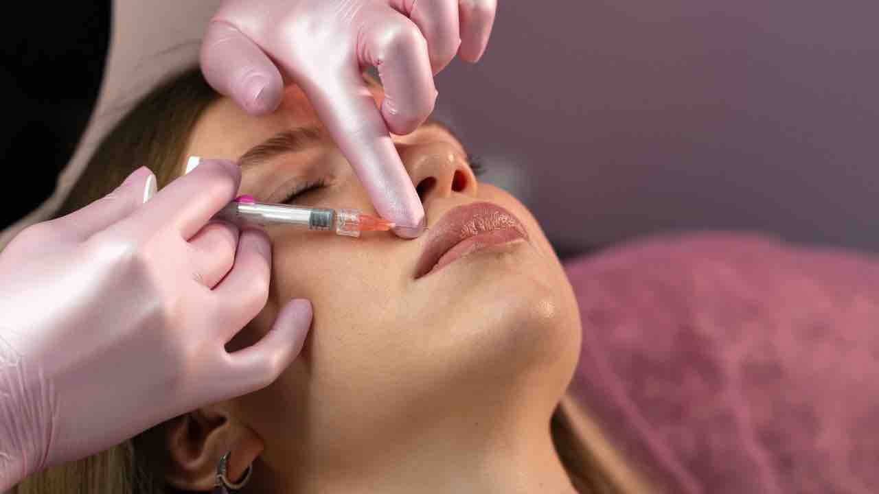 filler labbra