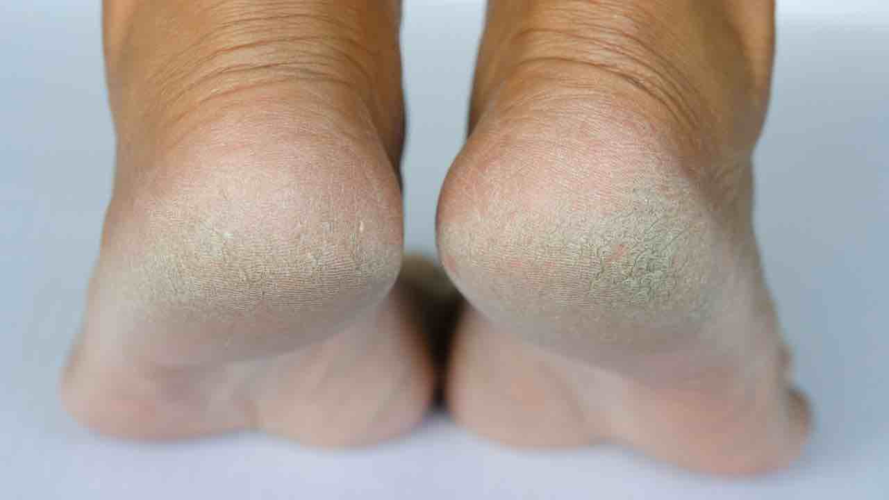 piedi secchi
