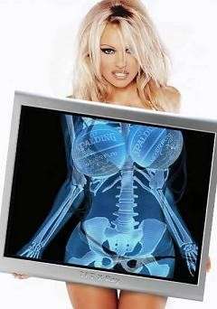 silicone