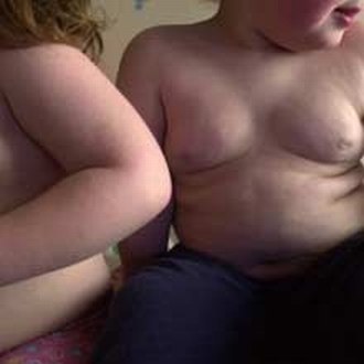 obese children