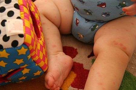 gambe bimbo