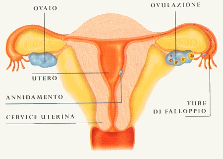tumore delle ovaie