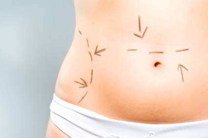 addio liposuzione