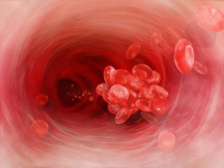 Setticemia scoprire i sintomi