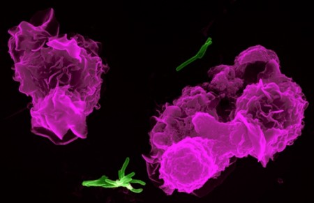 batteri tubercolosi contagio mamma