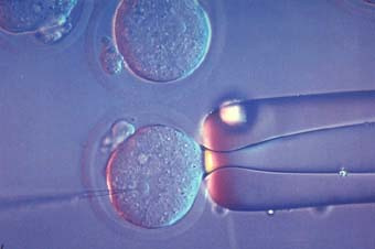 fecondazione assistita immagini microscopio