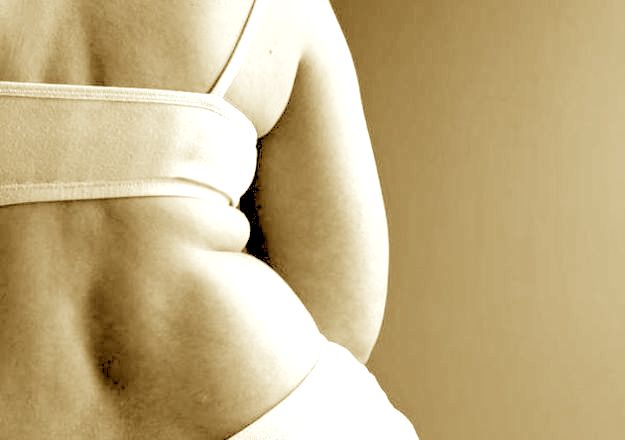 bypass gastrico costi come funziona