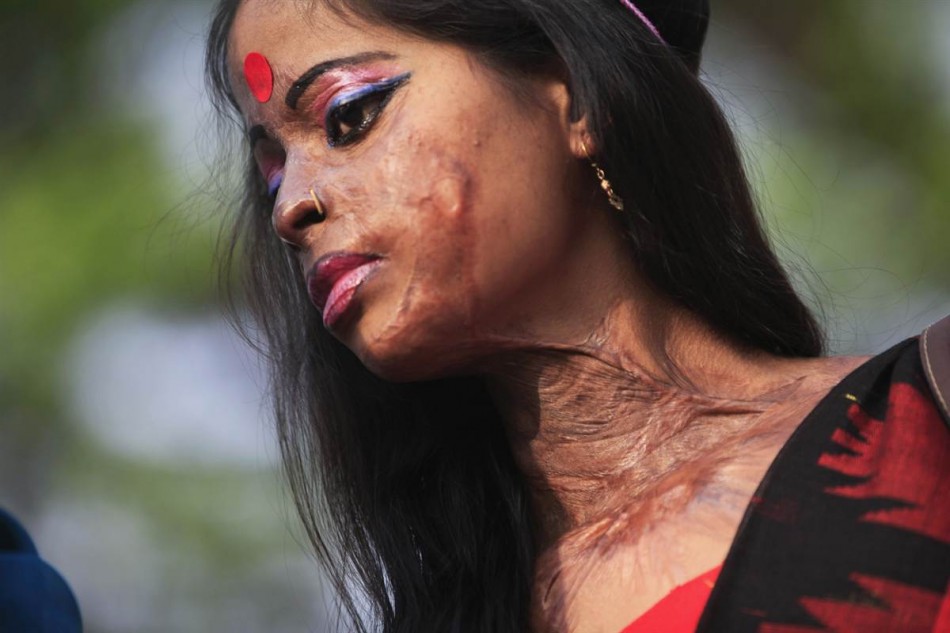 acido donne india