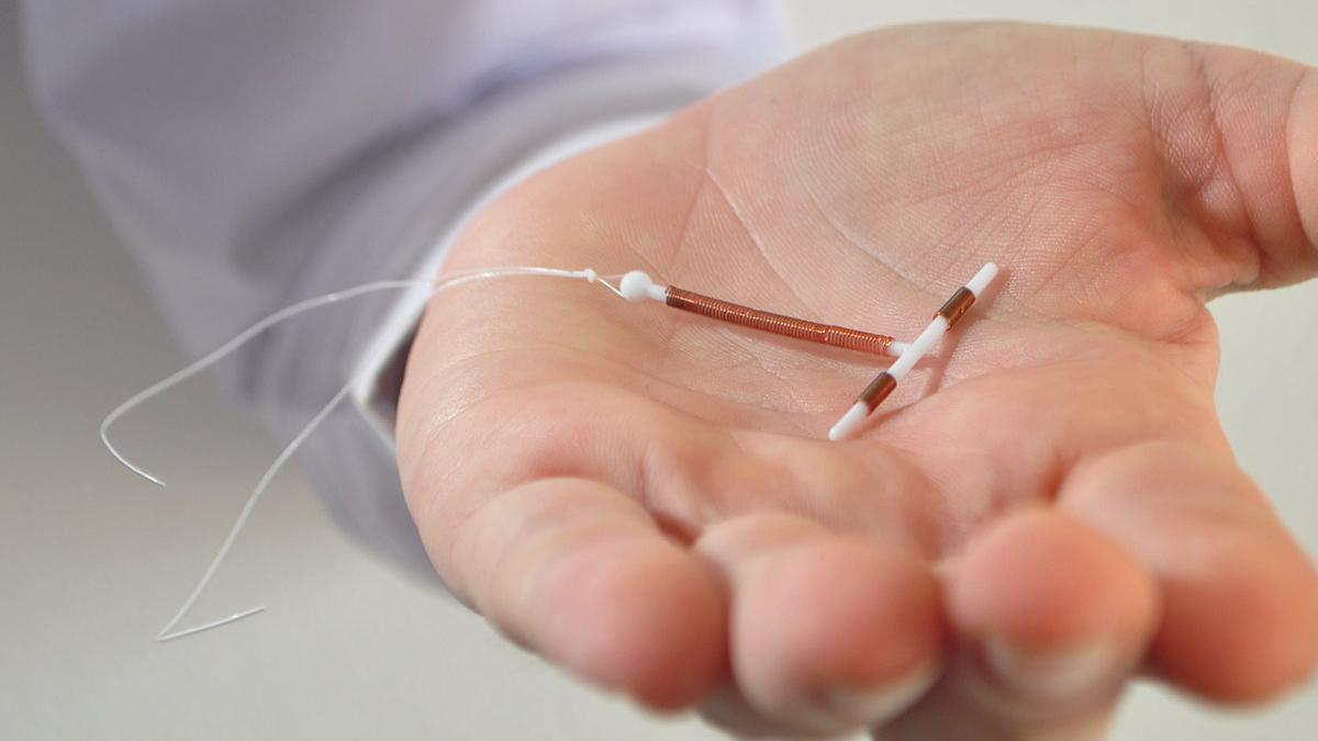 Spirale anticoncezionale costo utilizzo efficacia e controindicazioni