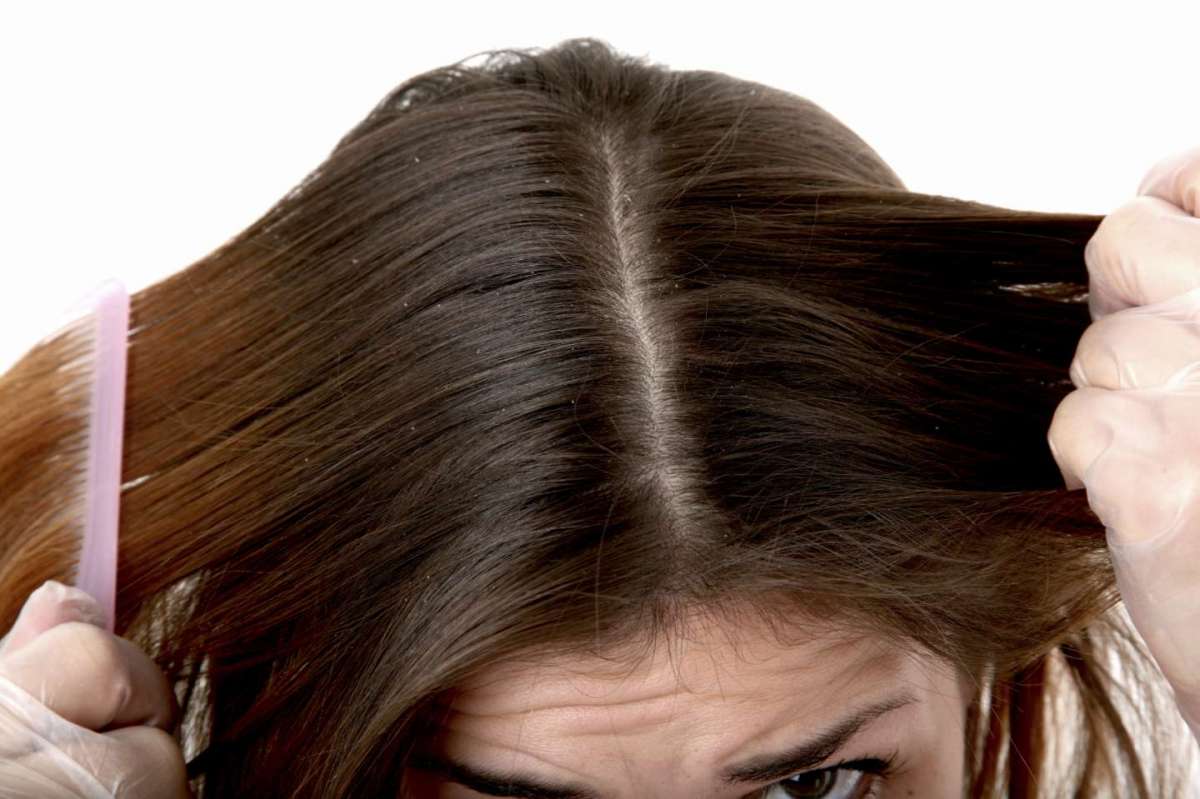 Scrub per capelli i prodotti migliori da provare