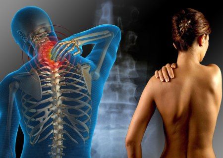 fibromialgia
